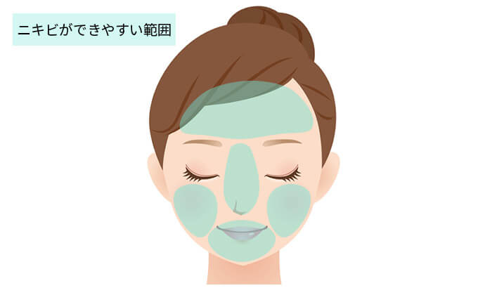 ニキビができやすい範囲