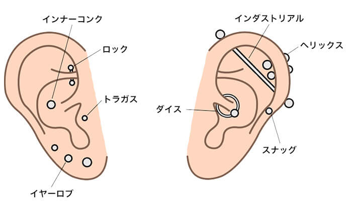 皮膚科で開けられる部位