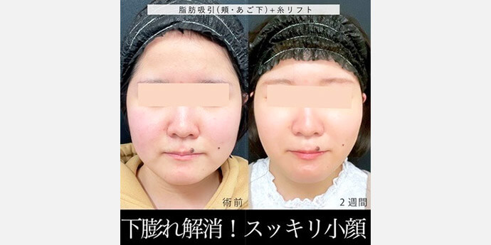 東京シンデレラ美容外科新宿院