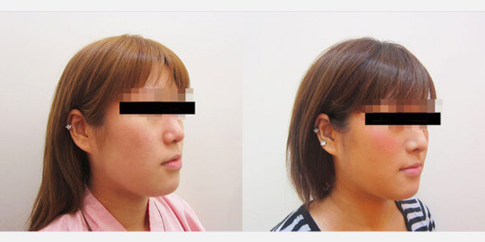 大阪雅美容外科