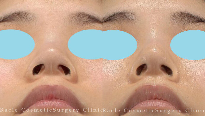 新宿ラクル美容外科クリニック