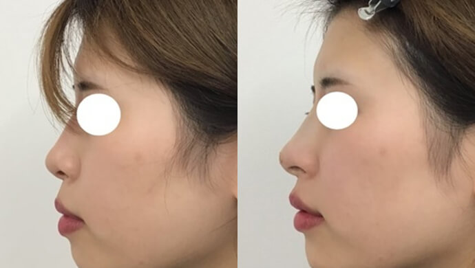 東郷美容形成外科福岡