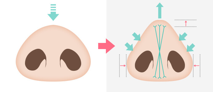 クレオパトラノーズ