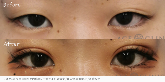 エースクリニック大阪梅田院