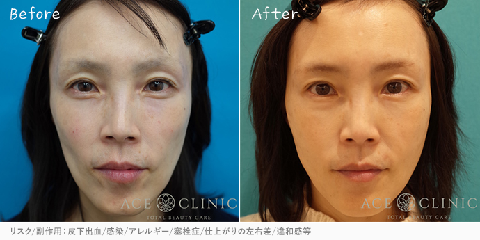 エースクリニック大阪梅田院