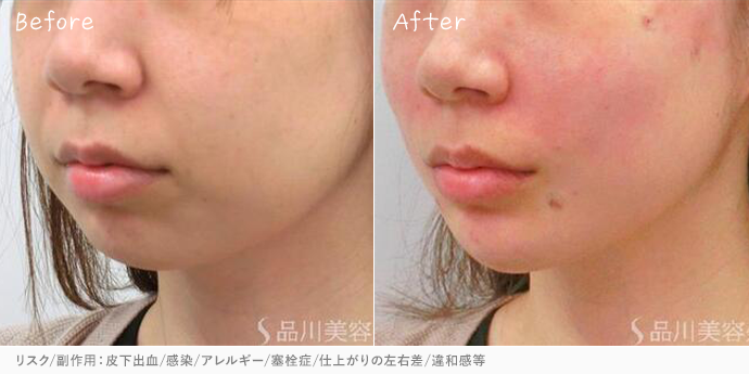 品川美容外科名古屋院