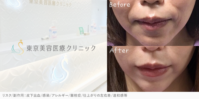 東京美容医療クリニック