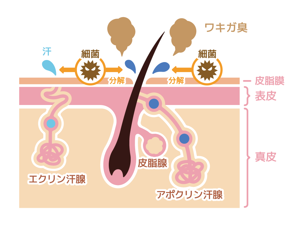 ワキガ・多汗症解説