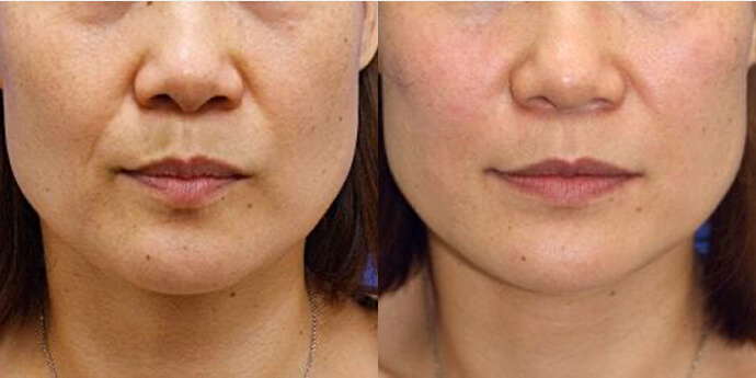 オザキクリニック