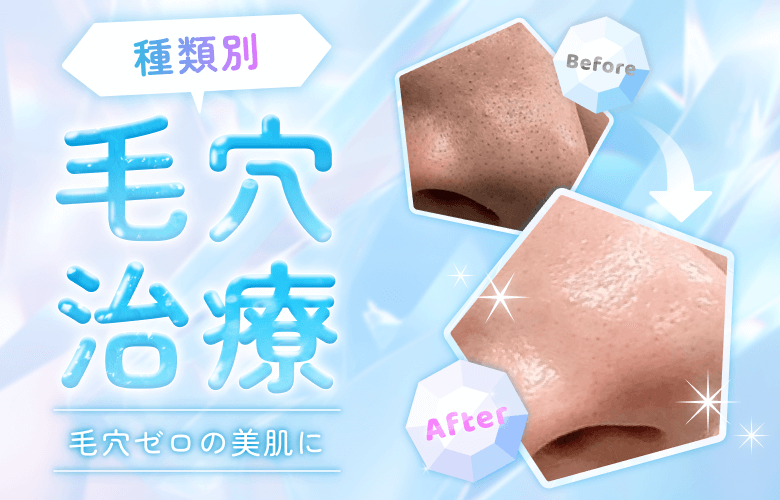 毛穴ゼロの美肌に！毛穴の種類＆おすすめ治療法