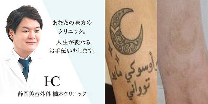 静岡美容外科橋本クリニック