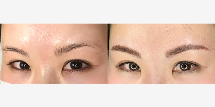 心斎橋フェミークリニック